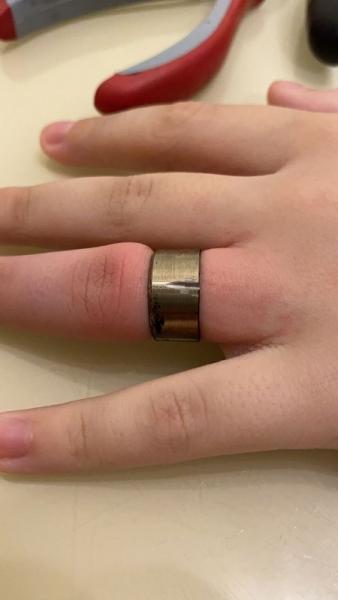 Спасатели ГКУ МО «Мособлпожспас» сняли кольцо от шампура, застрявшее на пальце ребенка